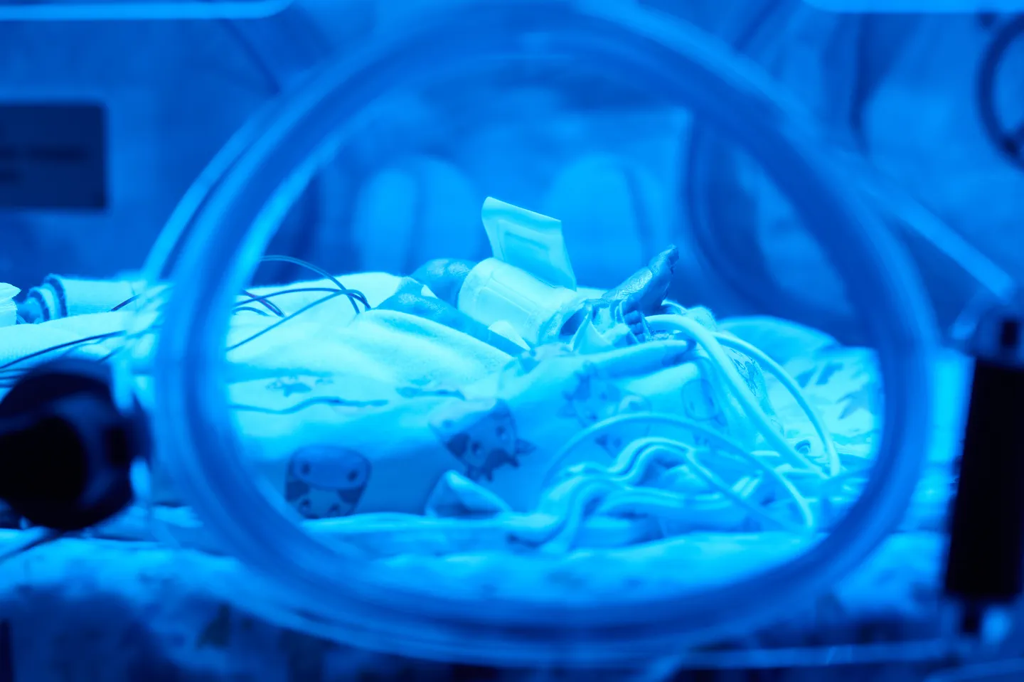 Tanzania: Tweaked labour law helps parents of premature babies